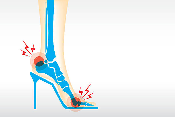 High Heel pain
